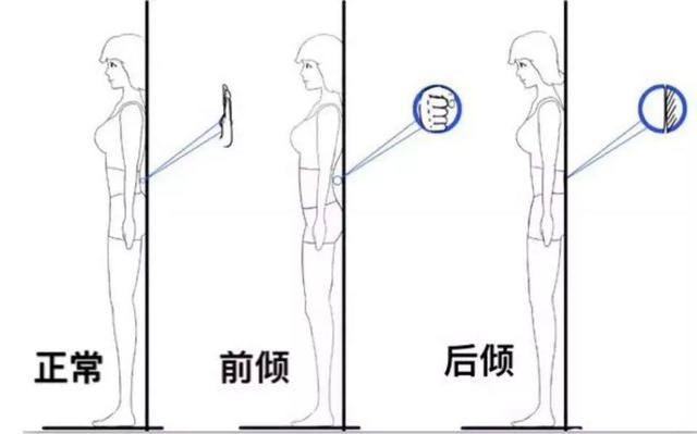 頸椎生理曲度(2) :: WilfredP